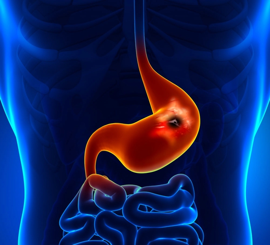 如何治疗胃病 慢性胃炎自疗按摩妙法