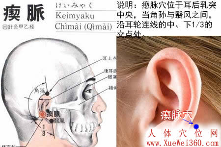 瘈脉穴