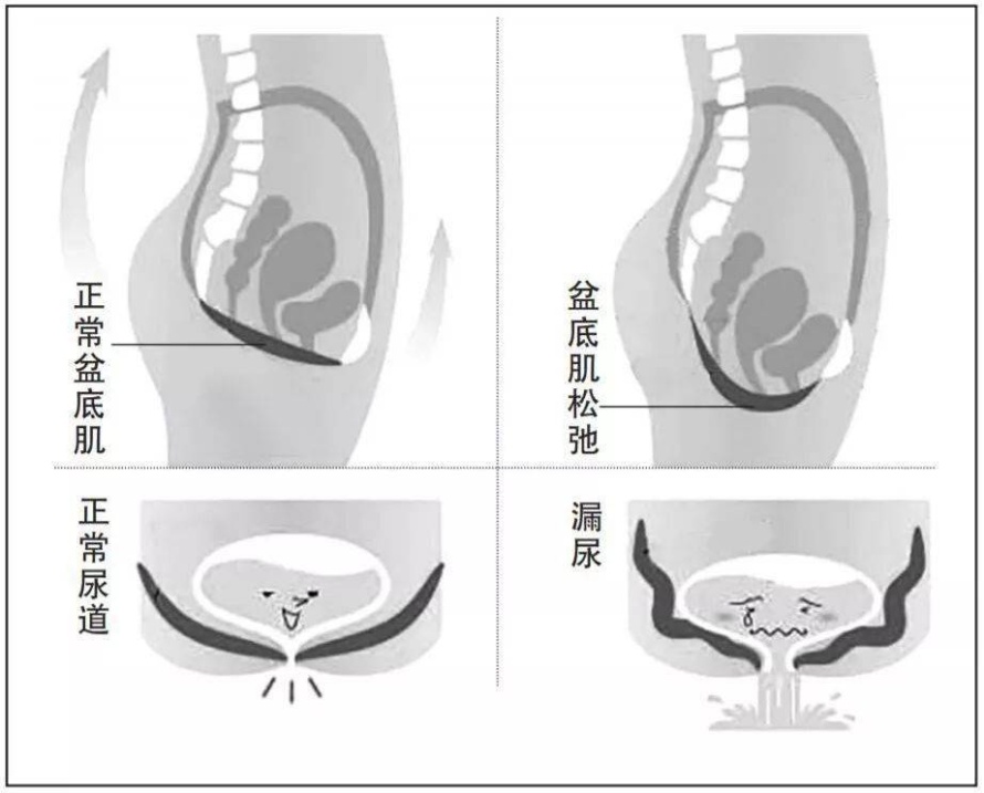 盆底肌恢复和提升，一定要练的8个动作！