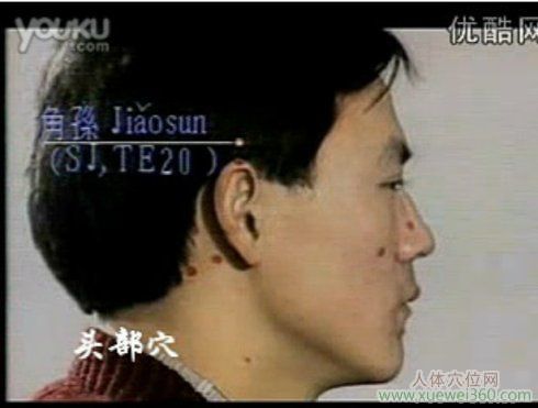 角孙穴