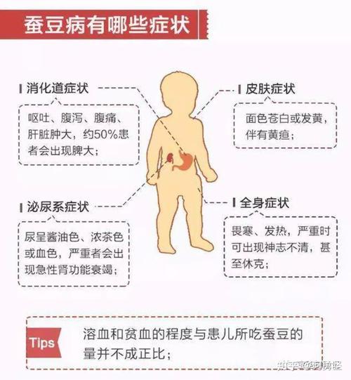 蚕豆病的症状,蚕豆病的症状有哪些