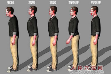 关于鸡胸、驼背的中医按摩方法