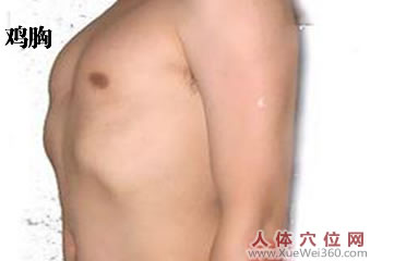 关于驼背、鸡胸的按摩方法