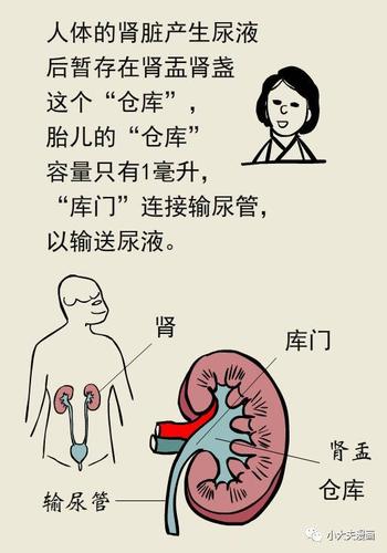 肾积水症状,孕妇肾积水症状