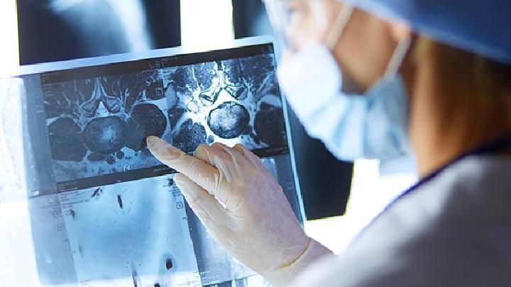 尖锐湿疣症状表现哪些最明显 分析男女尖锐湿疣的症状表现