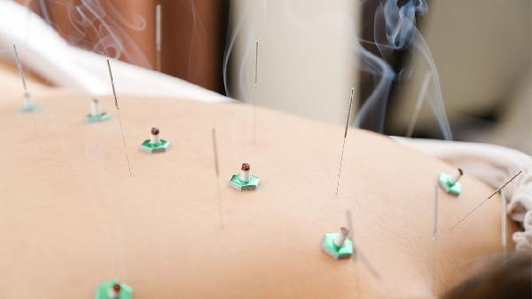 艾灸去哪里做比较好