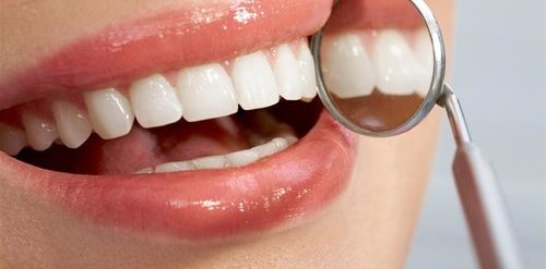 青年 女 牙科 牙医 牙齿 口镜_14505328_xxl